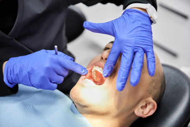Best Urgent Care for Lost Fillings or Crowns in Mercer, PA